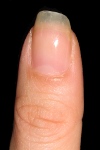 Claudia's left thumb