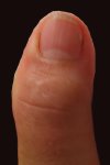 Leondine's left thumb