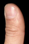 Michael's left thumb