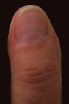 Wilfried's right thumb